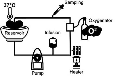 Complement Is Activated During Normothermic Machine Perfusion of Porcine and Human Discarded Kidneys